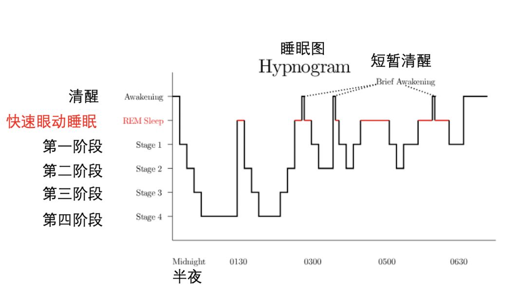 睡眠图(睡眠时的脑电图)显示了睡眠周期中逐渐增加的rem睡眠