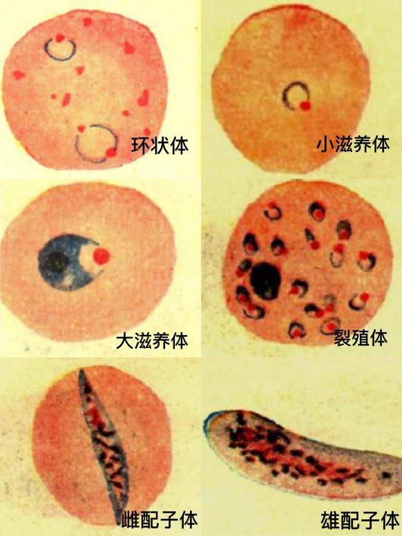 对的"时间"(青蒿素还在半衰期内),遇上对的"人"(处于中晚期的疟原虫)