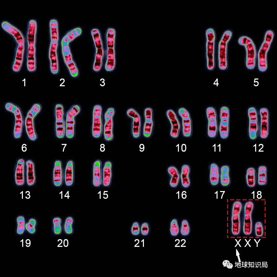y染色体遗传图图片